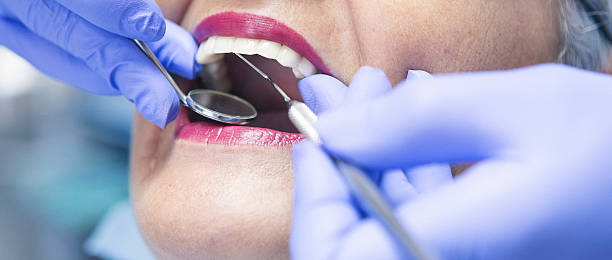 Best Emergency Cosmetic Dentistry (e.g., broken veneers) in Sanborn, IA